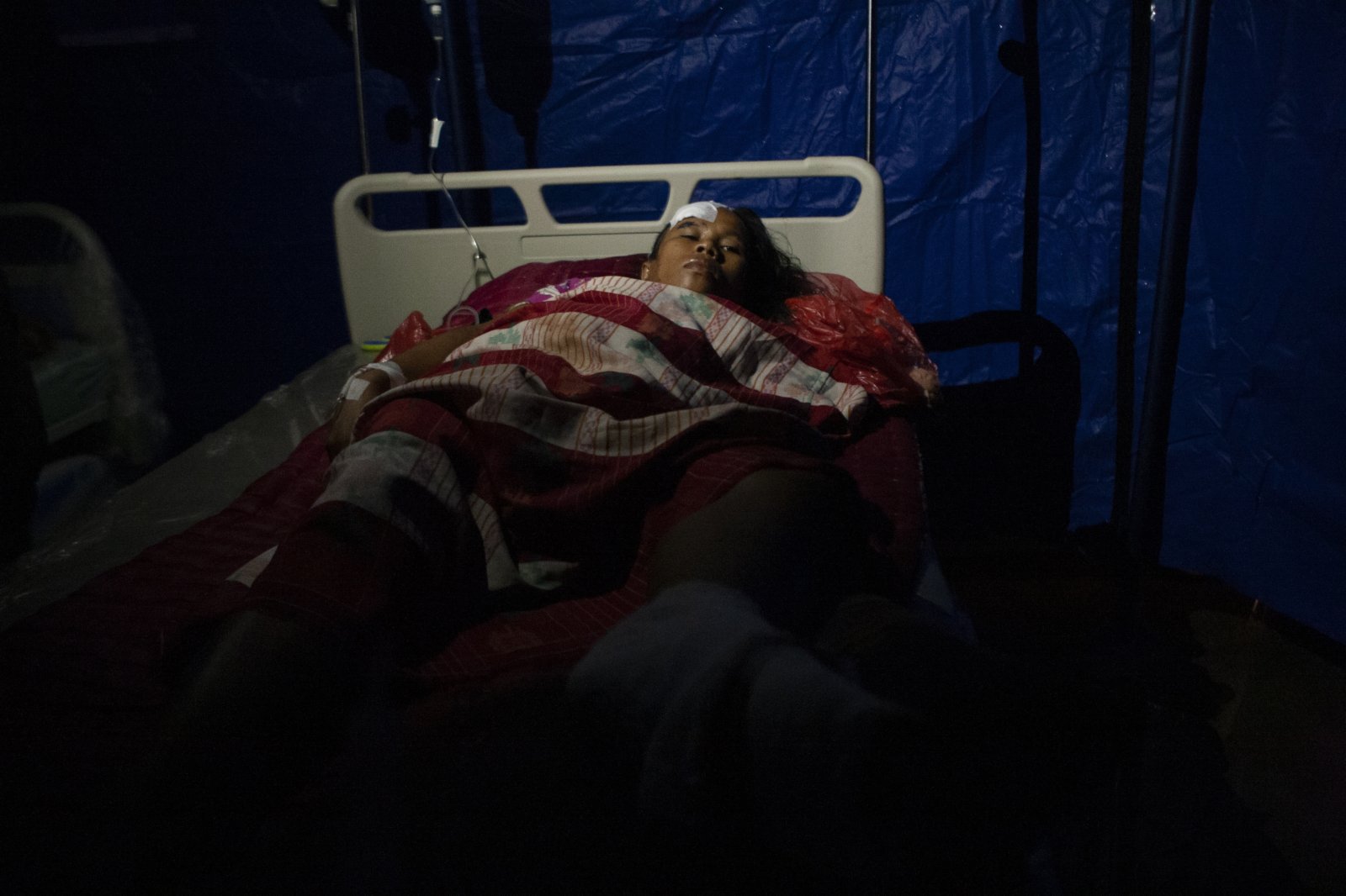 1月15日凌晨印尼西蘇拉威西省發生6.2級地震，已致42人死亡。圖為一名地震中受傷的女子接受治療。（新華社）
