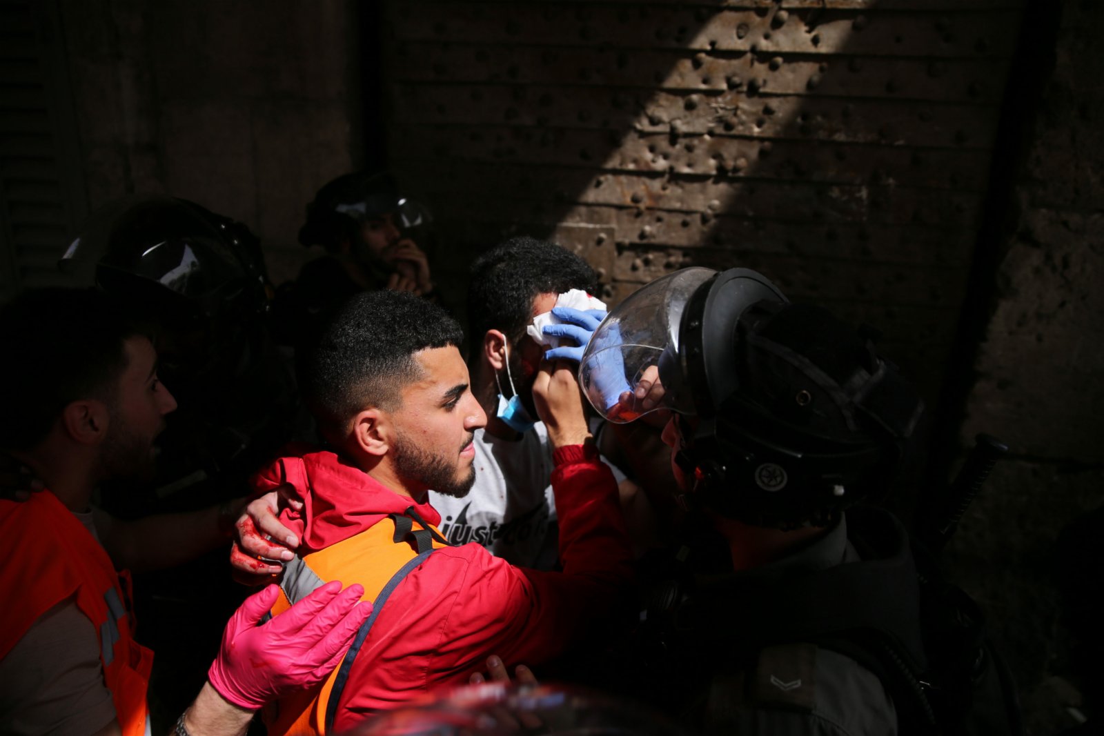 5月10日，在耶路撒冷老城聖殿山（穆斯林稱「尊貴禁地」）附近，一名巴勒斯坦示威者受傷送醫。