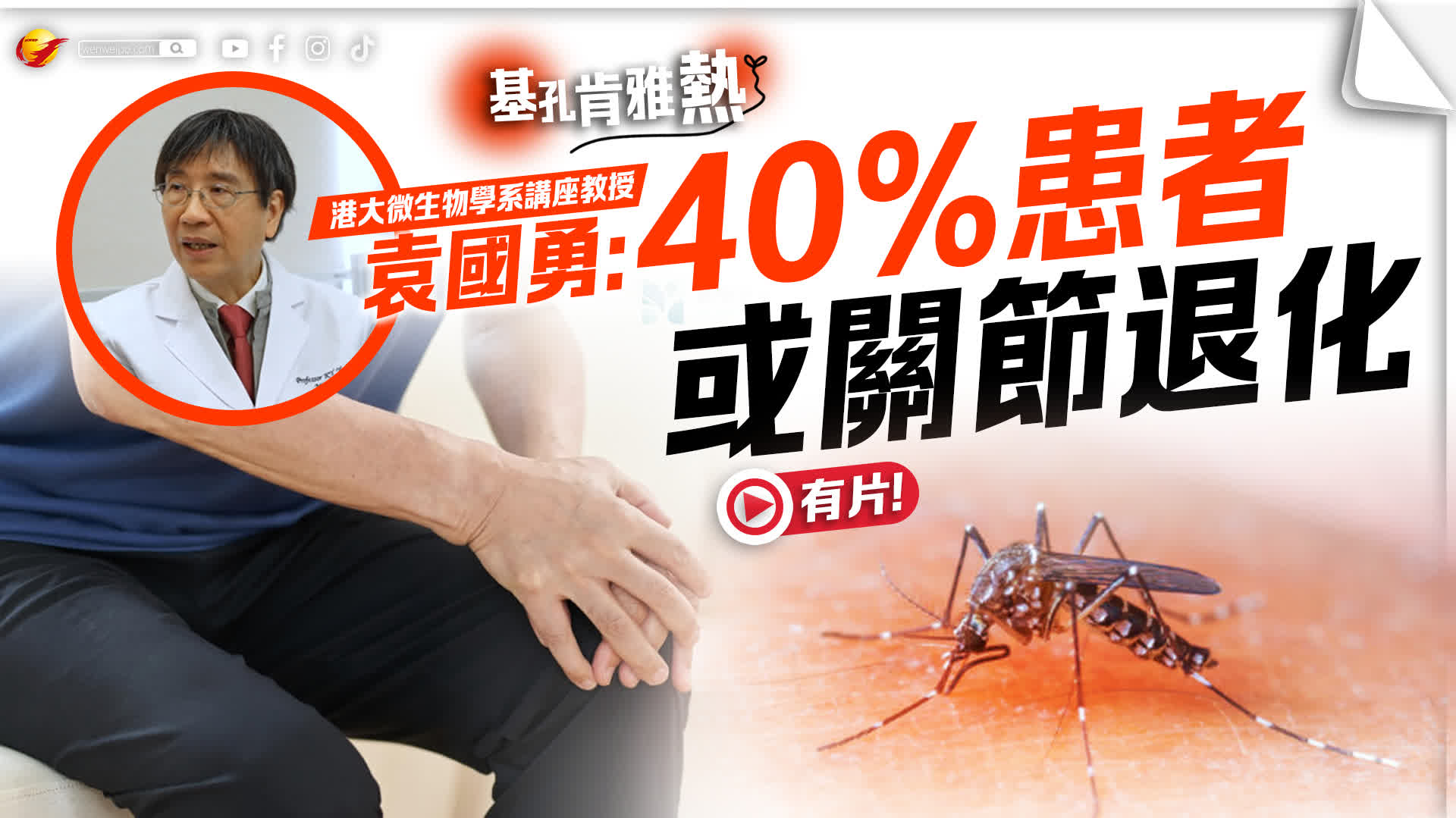 文匯專訪 | 袁國勇警告：基孔肯雅熱40%患者或關節退化