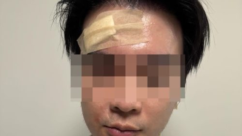 「行兇者說我報警會殺掉我倆」 代購網兩港人韓國遇襲周身傷 懸紅50萬緝主謀