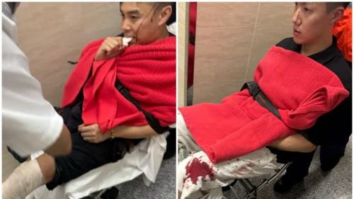 (有片)海關緝毒人員土瓜灣遇襲過程曝光  3人浴血手腳有10厘長刀傷