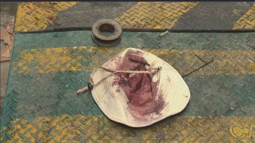 銅鑼灣後巷遭墮下金屬物擊中婦人 傷者留醫11日不治